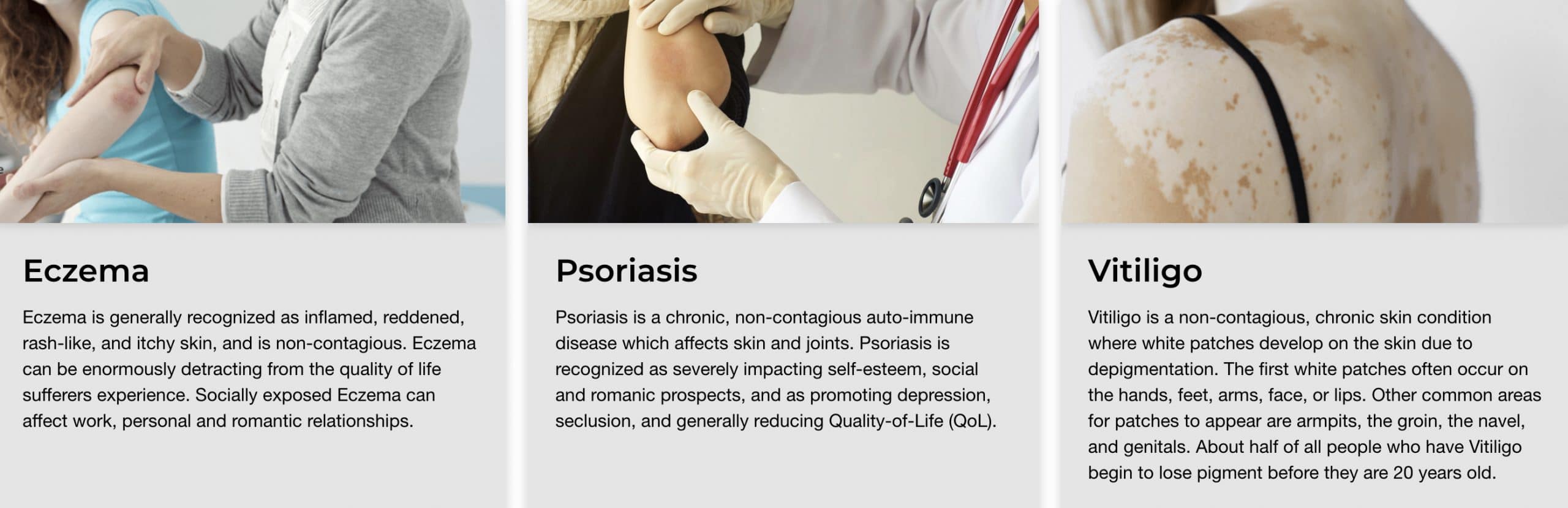 Treatments for psoriasis